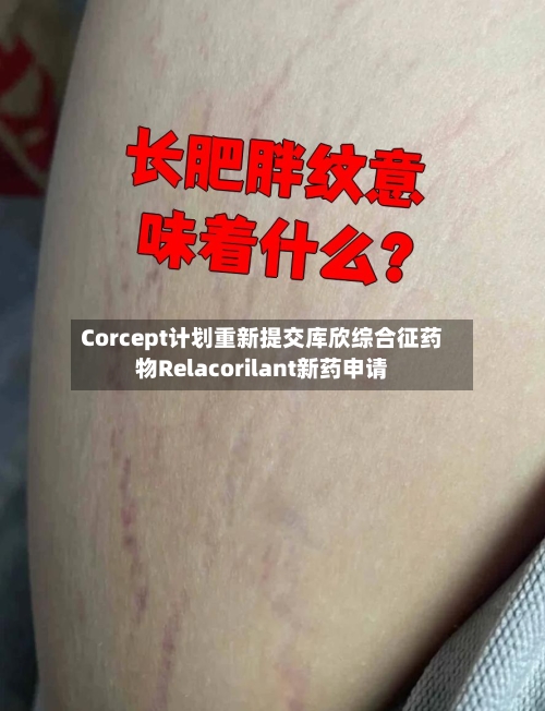 Corcept计划重新提交库欣综合征药物Relacorilant新药申请