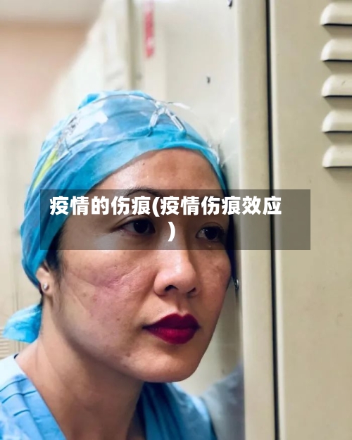 疫情的伤痕(疫情伤痕效应)-第3张图片